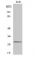 Casein Kinase IIβ Polyclonal Antibody